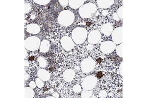 Immunohistochemical staining of human bone marrow with ARAP2 polyclonal antibody  shows strong cytoplasmic positivity in bone marrow poietic cells at 1:500-1:1000 dilution. (ARAP2 anticorps)
