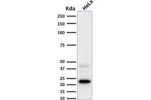 Western Blot Analysis of human HeLa cell lysate using Ferritin, Light Chain Mouse Monoclonal Antibody (FTL/1387).