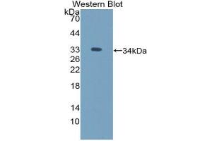 Western blot analysis of the recombinant protein. (ICAM5 anticorps  (AA 164-441))