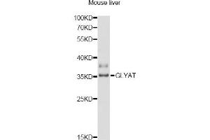Western blot analysis of extracts of mouse liver, using GLYAT antibody (ABIN6293111) at 1:3000 dilution. (GLYAT anticorps)
