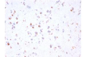 Formalin-fixed, paraffin-embedded human Cerebellum stained with FCGRT Mouse Monoclonal Antibody (FCGRT/2932). (FcRn anticorps  (AA 24-215))
