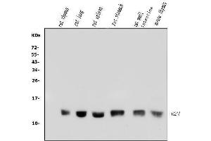 Western blot analysis of Beta 2 Microglobulin/B2m using anti-Beta 2 Microglobulin/B2m antibody (ABIN7600594).