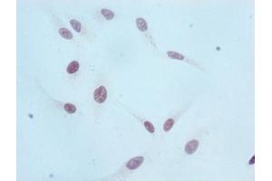 Immunocytochemistry analysis of ABIN7127301 diluted at 1:100 and staining in Hela cells performed on a Leica BondTM system.