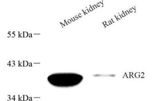 Western blot analysis of Arg2 (ABIN7073115),at dilution of 1: 600 (ARG2 anticorps)