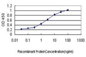 Detection limit for recombinant GST tagged ADRM1 is approximately 0. (ADRM1 anticorps  (AA 18-407))