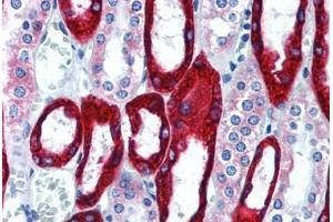 Human Kidney (formalin-fixed, paraffin-embedded) stained with KRT19 antibody ABIN292298 at 10 ug/ml followed by biotinylated anti-mouse IgG secondary antibody ABIN481714, alkaline phosphatase-streptavidin and chromogen. (Cytokeratin 19 anticorps)