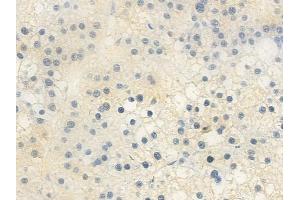 anti-Apolipoprotein B mRNA Editing Enzyme, Catalytic Polypeptide-Like 4 (Putative) (APOBEC4) (C-Term) antibody