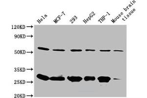 Western Blot Positive WB detected in: Mouse spleen tissue All lanes: RPL19 antibody at 2 μg/mL Secondary Goat polyclonal to rabbit IgG at 1/50000 dilution Predicted band size: 24 kDa Observed band size: 24 kDa (RPL19 anticorps  (AA 79-196))