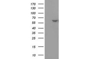 Western Blotting (WB) image for anti-Dystrobrevin alpha (DTNA) antibody (ABIN1497912) (DTNA anticorps)