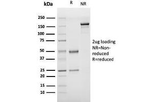 SDS-PAGE Analysis Purified vWF Recombinant Mouse Monoclonal Antibody (rVWF/1465).