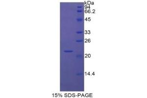 SDS-PAGE of Protein Standard from the Kit  (Highly purified E. (VCAM1 Kit ELISA)