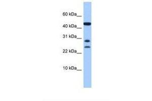 Image no. 1 for anti-Chromosome 20 Open Reading Frame 141 (C20orf141) (AA 91-140) antibody (ABIN6739362) (C20orf141 anticorps  (AA 91-140))