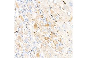 Immunohistochemistry of paraffin-embedded human liver using Perilipin-2 antibody (ABIN7269220) at dilution of 1:1600 (40x lens). (ADRP anticorps)