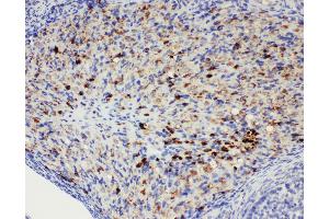 Anti-DDX4/MVH antibody, IHC(P) IHC(P): Rat Ovary Tissue