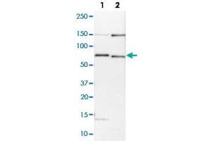 Western blot analysis of Lane 1: NIH-3T3 cell lysate (Mouse embryonic fibroblast cells); Lane 2: NBT-II cell lysate (Rat Wistar bladder tumour cells) with BIRC3 polyclonal antibody  at 1:100-1:250 dilution. (BIRC3 anticorps)