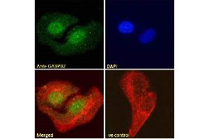 ABIN190778 Immunofluorescence analysis of paraformaldehyde fixed U2OS cells, permeabilized with 0.