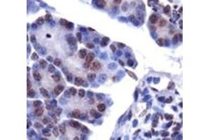 Staining of LPIN1 on mouse pancreas using LPIN1 polyclonal antibody . (Lipin 1 anticorps  (AA 300-400))