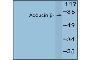 Western blot analysis of Beta-Adducin Antibody in extracts from 293 cells. (ADD2 anticorps)