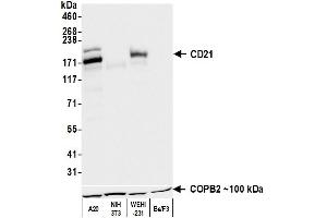 Western Blotting (WB) image for anti-Complement Component (3d/Epstein Barr Virus) Receptor 2 (CR2) (C-Term) antibody (ABIN7795815) (Recombinant CD21 anticorps  (C-Term))
