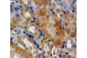 Used in DAB staining on fromalin fixed paraffin-embedded Kidney tissue