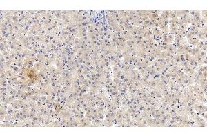 Detection of VF in Human Liver Tissue using Monoclonal Antibody to Visfatin (VF) (NAMPT anticorps  (AA 1-491))