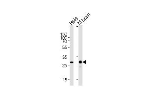 Western blot analysis of lysates from Hela cell line and mouse brain tissue lysate (from left to right) using CDK5 Antibody (ABIN1944859 and ABIN2843645). (CDK5 anticorps  (AA 160-286))