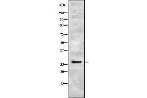 Western blot analysis IBP4 using K562 whole cell lysates (IGFBP4 anticorps  (Internal Region))