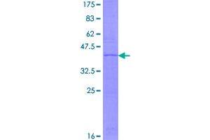 Image no. 1 for NADH Dehydrogenase (Ubiquinone) 1 alpha Subcomplex, 11, 14.7kDa (NDUFA11) (AA 1-141) protein (GST tag) (ABIN1312211)