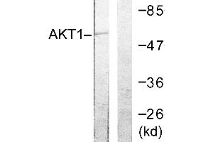 Immunohistochemistry analysis of paraffin-embedded human ovary tissue using Akt (Ab-72) antibody. (AKT1 anticorps  (Thr72))