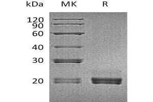 Western Blotting (WB) image for CD40 Ligand (CD40LG) (Active) protein (His tag) (ABIN7320848)