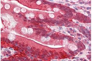 Human Small Intestine (formalin-fixed, paraffin-embedded) stained with FABP2 antibody ABIN337124 at 2. (FABP2 anticorps  (AA 121-132))