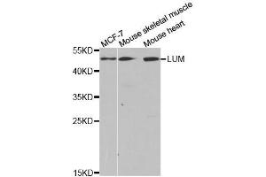 Western blot analysis of extracts of various cell lines, using LUM antibody. (LUM anticorps  (AA 19-338))