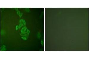 Immunofluorescence analysis of A549 cells, using NSE Antibody. (ENO2/NSE anticorps  (AA 371-420))