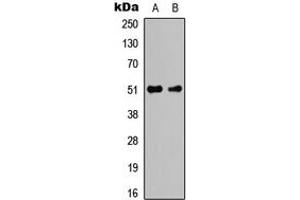 Western blot analysis of Caspase 2 expression in K562 (A), NIH3T3 (B) whole cell lysates. (Caspase 2 anticorps  (Center))