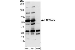 Western Blotting (WB) image for anti-LAP2 beta/tmpo (AA 225-275) antibody (ABIN7455055) (LAP2 beta/tmpo (AA 225-275) anticorps)