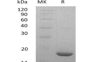 Western Blotting (WB) image for Leukemia Inhibitory Factor (LIF) protein (ABIN7320606) (LIF Protéine)