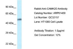Western Blotting (WB) image for anti-Calcium/calmodulin-Dependent Protein Kinase II delta (CAMK2D) (C-Term) antibody (ABIN2788811) (CAMK2D anticorps  (C-Term))