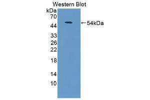 Detection of Recombinant LFA3, Human using Polyclonal Antibody to Cluster Of Differentiation 58 (CD58)