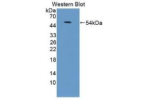 Detection of Recombinant LFA3, Human using Polyclonal Antibody to Cluster Of Differentiation 58 (CD58) (CD58 anticorps  (AA 1-214))