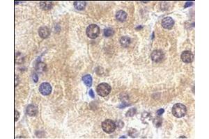 Immunohistochemistry of ST2 in mouse kidney tissue with this product at 2 μg/ml.