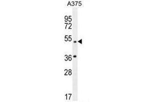 AP1M1 Antibody (Center) western blot analysis in A375 cell line lysates (35µg/lane). (AP1M1 anticorps  (Middle Region))