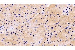 Detection of NRP1 in Human Cardiac Muscle Tissue using Monoclonal Antibody to Neuropilin 1 (NRP1) (Neuropilin 1 anticorps  (AA 646-814))