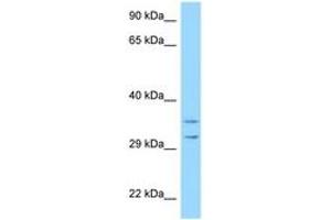 Image no. 1 for anti-Ribosomal Protein S2 (RPS2) (AA 99-148) antibody (ABIN6748128) (RPS2 anticorps  (AA 99-148))