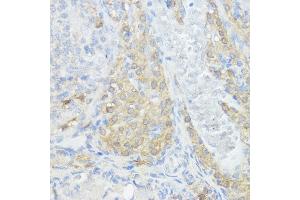 Immunohistochemistry of paraffin-embedded rat ovary using NOD1 antibody (ABIN3021837, ABIN3021838, ABIN3021839 and ABIN6216095) at dilution of 1:100 (40x lens).