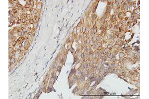 Image no. 1 for anti-Alveolar Soft Part Sarcoma Chromosome Region, Candidate 1 (ASPSCR1) (AA 1-554) antibody (ABIN466238) (ASPSCR1 anticorps  (AA 1-554))