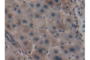 Detection of PPARa in Human Liver Tissue using Polyclonal Antibody to Peroxisome Proliferator Activated Receptor Alpha (PPARa)