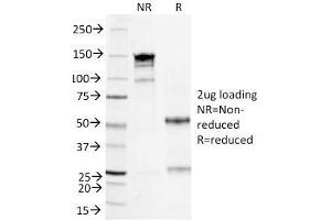 SDS-PAGE Analysis Purified Serum Amyloid A Mouse Monoclonal Antibody (SAA/326). (SAA anticorps)