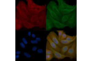 ESPN Mouse Monoclonal Antibody staining Hela cells by IF/ICC.