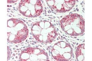 Human Colon: Formalin-Fixed, Paraffin-Embedded (FFPE).