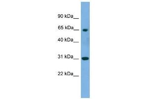 PNKP antibody used at 1 ug/ml to detect target protein. (PNKP anticorps  (Middle Region))